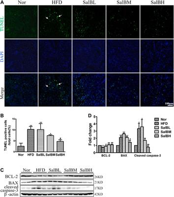 Salvianolic Acid B Protects Against Fatty Acid-Induced Renal Tubular Injury via Inhibition of Endoplasmic Reticulum Stress